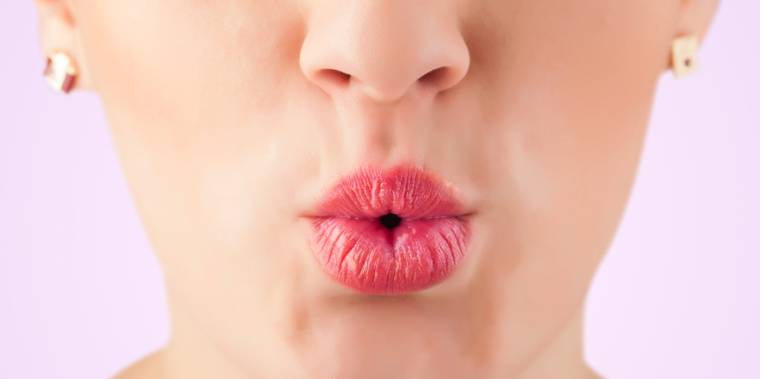 Lip Flip vs. Lip Fillers: What’s the Difference?