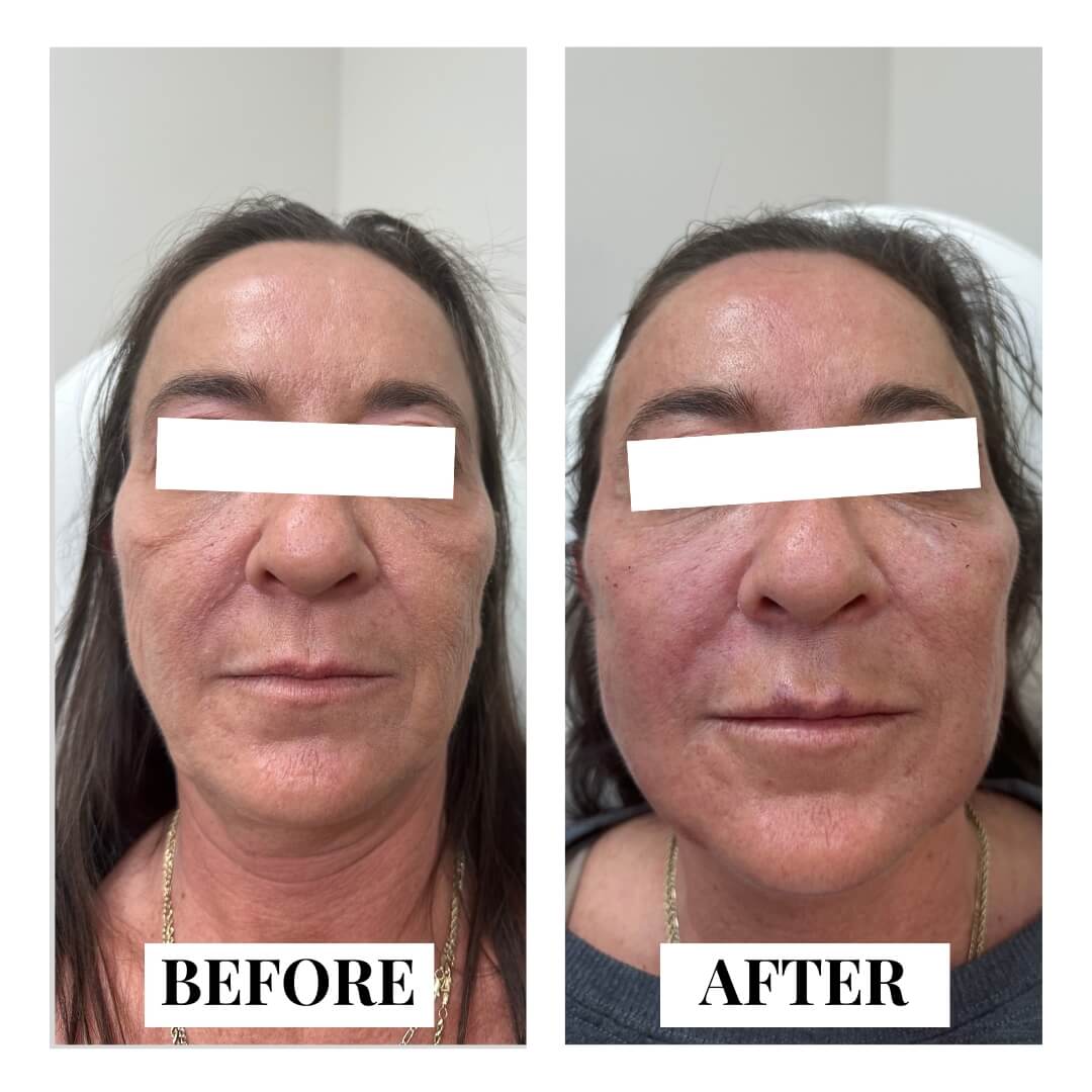 Facial Contours Advanced Treatments - New Medical Spa