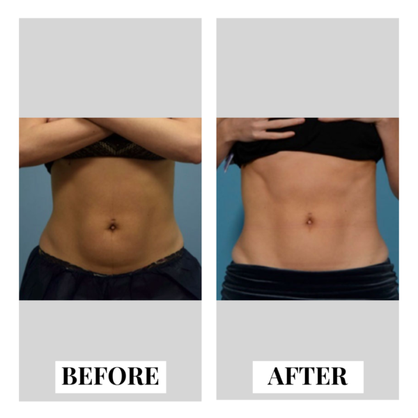 PERMANENTLY ELIMINATE TREATED FAT visual data 8